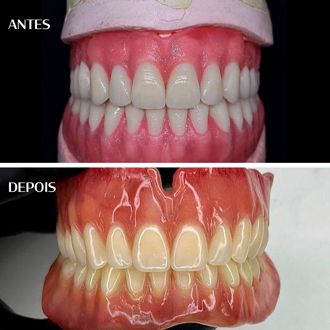 Antes e depois - Taissom Farias