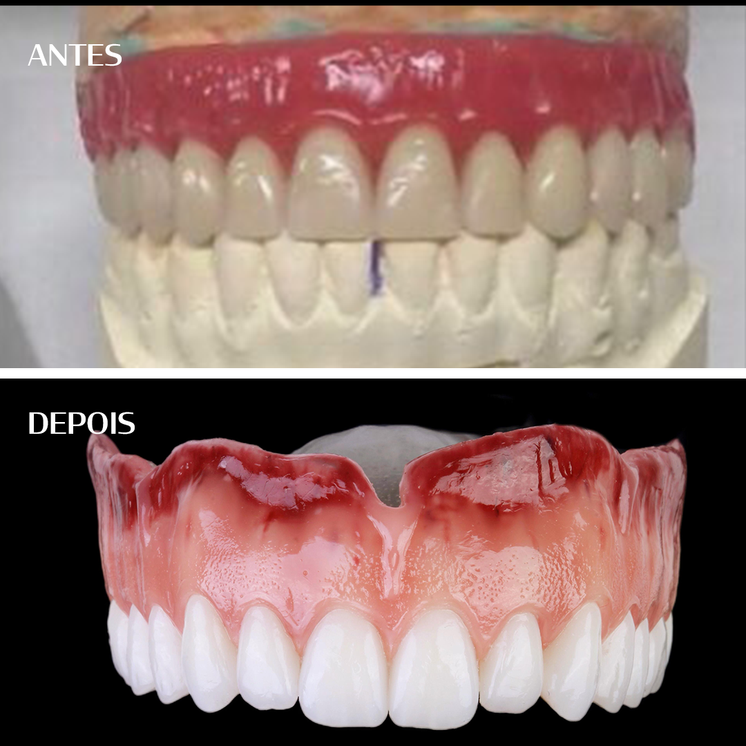 Antes e depois - David Junior
