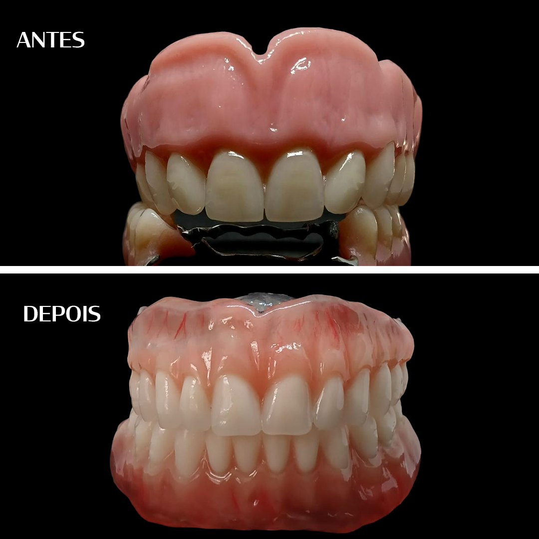 Antes e depois - Geo Oliveira