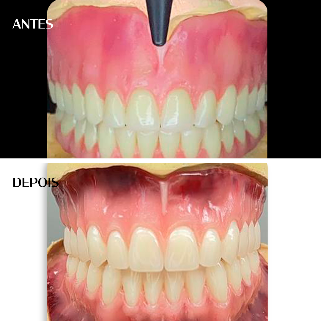 Antes e depois - Paulo Souza