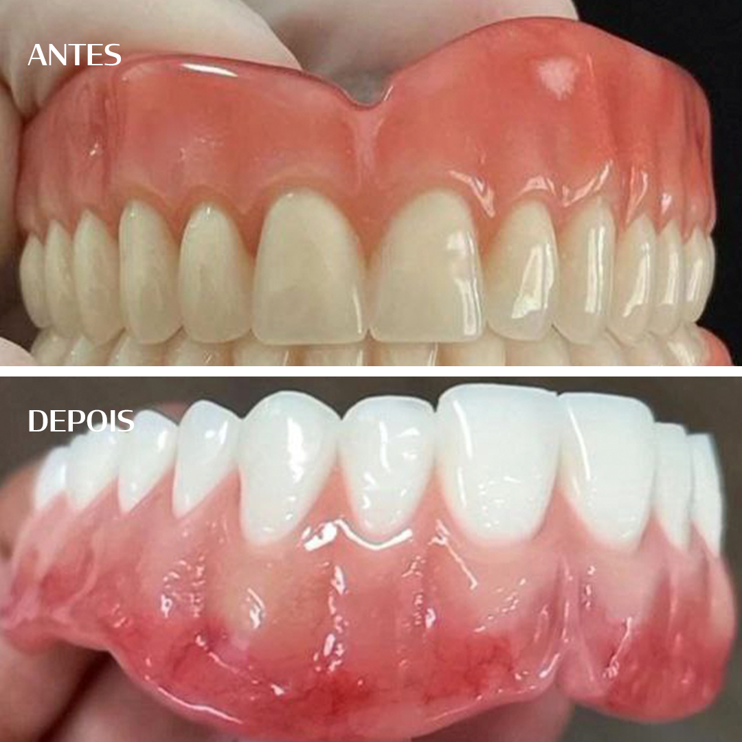 Antes e depois - William Barbosa