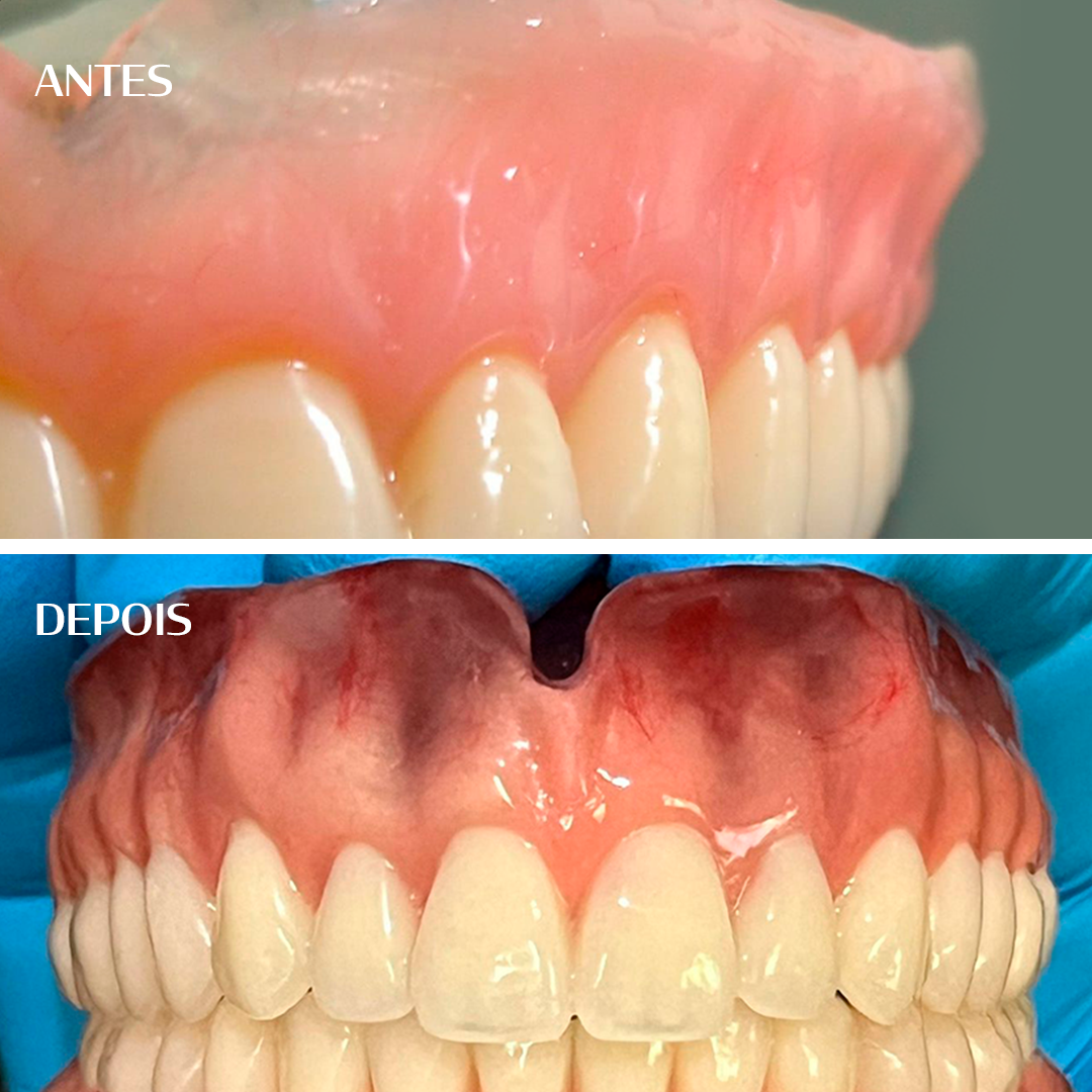 Antes e depois - Adrian Pimentel